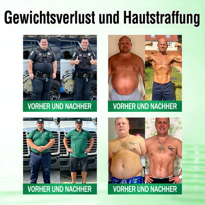 𝑶𝒇𝒇𝒊𝒛𝒊𝒆𝒍𝒍𝒆𝒓 𝑺𝒉𝒐𝒑 | 🍀🍀𝐂𝐚𝐫𝐞𝐔𝐩𝐥𝐢𝐟𝐭® 𝑴𝒆𝒕𝒂𝒃𝒐𝒍𝒊𝒔𝒄𝒉𝒆𝒔 𝑵𝒂𝒏𝒐-𝑴𝒊𝒌𝒓𝒐𝒏𝒂𝒅𝒆𝒍-𝑷𝒇𝒍𝒂𝒔𝒕𝒆𝒓 🇩🇪 （𝐍𝐮𝐫 𝐞𝐢𝐧𝐦𝐚𝐥 𝐭ä𝐠𝐥𝐢𝐜𝐡, 𝐬𝐢𝐜𝐡𝐭𝐛𝐚𝐫𝐞 𝐕𝐞𝐫ä𝐧𝐝𝐞𝐫𝐮𝐧𝐠𝐞𝐧 𝐢𝐧 𝟕 𝐓𝐚𝐠𝐞𝐧）  𝘽𝙚𝙧𝙗𝙚𝙧𝙞𝙣 + 𝙈𝙤𝙧𝙞𝙣𝙜𝙖-𝙁𝙤𝙧𝙢𝙚𝙡 ✅ 𝐅ü𝐫 𝐀𝐝𝐢𝐩𝐨𝐬𝐢𝐭𝐚𝐬, 𝐬𝐜𝐡𝐥𝐚𝐟𝐟𝐞 𝐇𝐚𝐮𝐭, 𝐃𝐢𝐚𝐛𝐞𝐭𝐞𝐬, 𝐒𝐜𝐡𝐥𝐚𝐟𝐚𝐩𝐧𝐨𝐞, 𝐆𝐞𝐥𝐞𝐧𝐤𝐛𝐞𝐬𝐜𝐡𝐰𝐞𝐫𝐝𝐞𝐧 𝐮𝐧𝐝 𝐦𝐞𝐡𝐫 💯💯